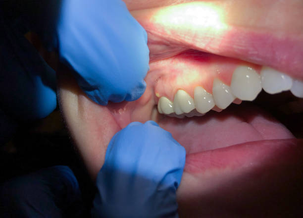 Best Emergency Dental Care for Trauma or Injury in Mohnton, PA