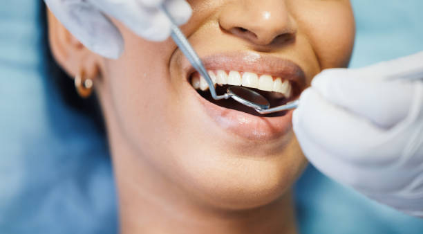 Best Emergency Wisdom Teeth Removal in Mohnton, PA